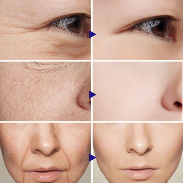 Instant Remove Wrinkle Cream Retinol Anti-Aging Fade Fine Lines Reduce Wrinkles Lifting Firming Cream Face Skin Care Products - Image 2